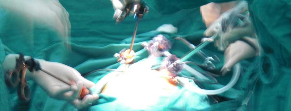 laparoscopy or keyhole surgery